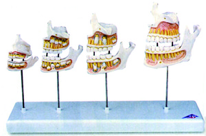 牙齒發育模型(3B)