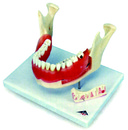 2倍大牙齒病理模型(3B)
