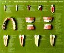 牙齒保健模型(德製SO出SO)