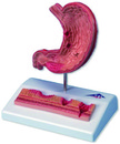 胃病理模型(3B)